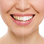 Tiras blanqueamiento dental 3D white ⚠️POTENTE⚠️