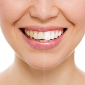 Tiras blanqueamiento dental 3D white ⚠️POTENTE⚠️