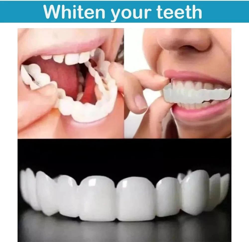 😁 Transforma tu sonrisa fácil, rápido y sin dolor  🔵 Snapon Smile 🏅100% ORIGINAL🏅